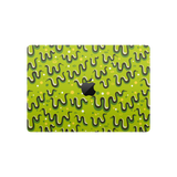 MacBook Pro 14-Inch M1 2021 Full Wrap Top Bravo