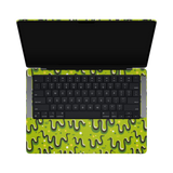 MacBook Pro 14-Inch M1 2021 Full Wrap Top Inside Bravo